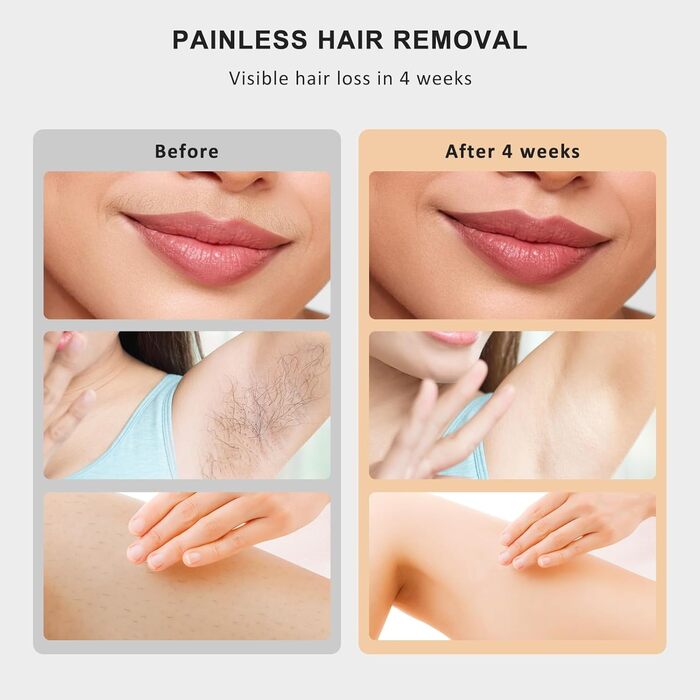 Пристрій для епіляції IPL NALONE, лазерне видалення волосся, 999 999 імпульсів, для жінок та чоловіків, 1200 нм, 2 режими, болюча епіляція для всього тіла, білий (золотий)