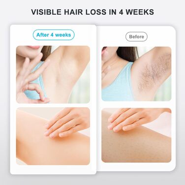 Пристрій для епіляції IPL NALONE: безболійна епіляція лазером для тіла, 1200 нм, 2 режими, для жінок та чоловіків