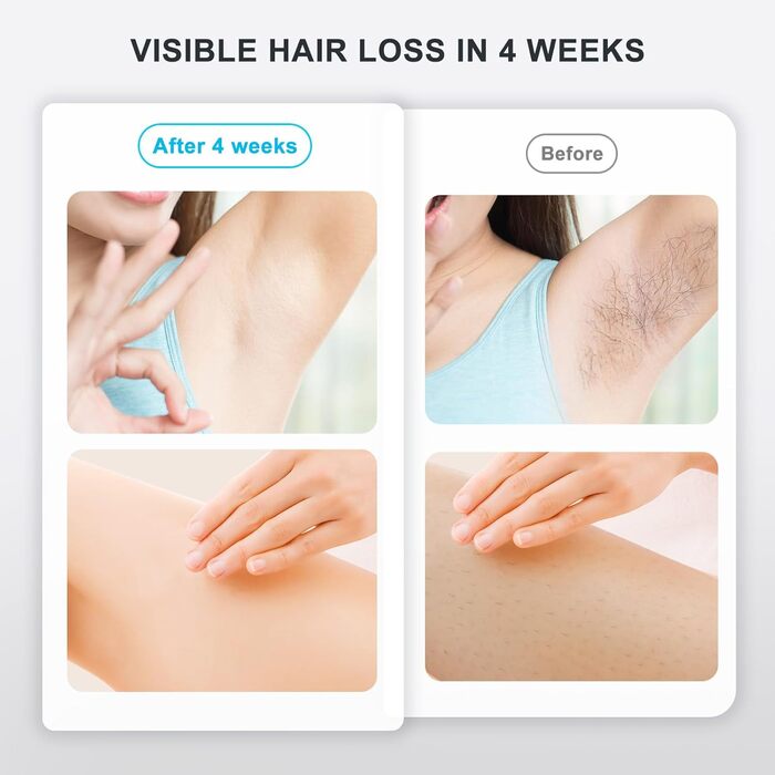 Пристрій для епіляції IPL NALONE: безболійна епіляція лазером для тіла, 1200 нм, 2 режими, для жінок та чоловіків