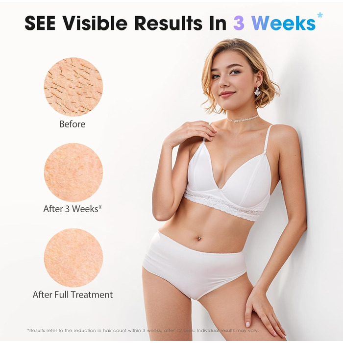 Пристрій для епіляції IPL з лазером та охолоджувальною функцією Haarlosy, 5 рівнів інтенсивності, 999 900 імпульсів світла, для жінок та чоловіків, обличчя, під пахвами, ноги, тіло (білий, рожевий)