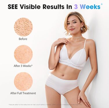 Пристрій для епіляції IPL з лазером та охолоджувальною функцією Haarlosy, 5 рівнів інтенсивності, 999 900 імпульсів світла, для жінок та чоловіків, обличчя, під пахвами, ноги, тіло (білий, рожевий)