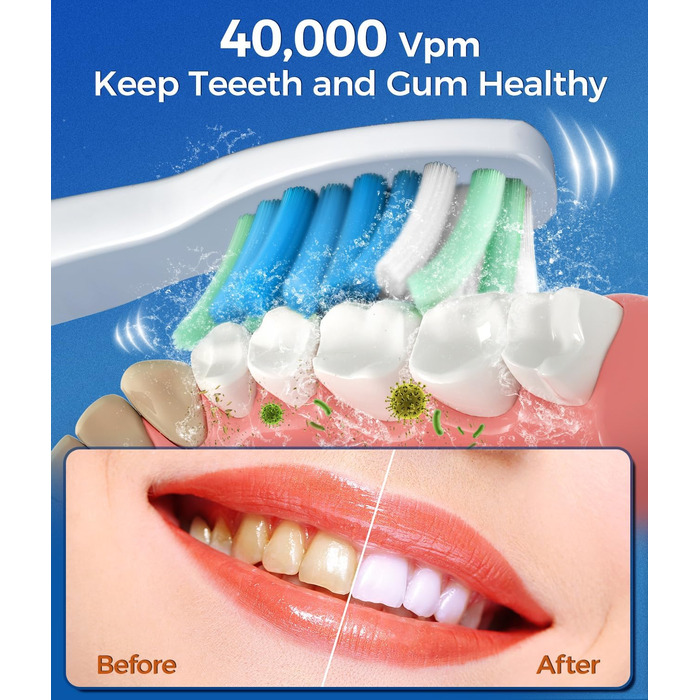 Електрична зубна щітка Demita зі 8 насадок, 40000 VPM, 5 режимів, швидка зарядка (30 днів)
