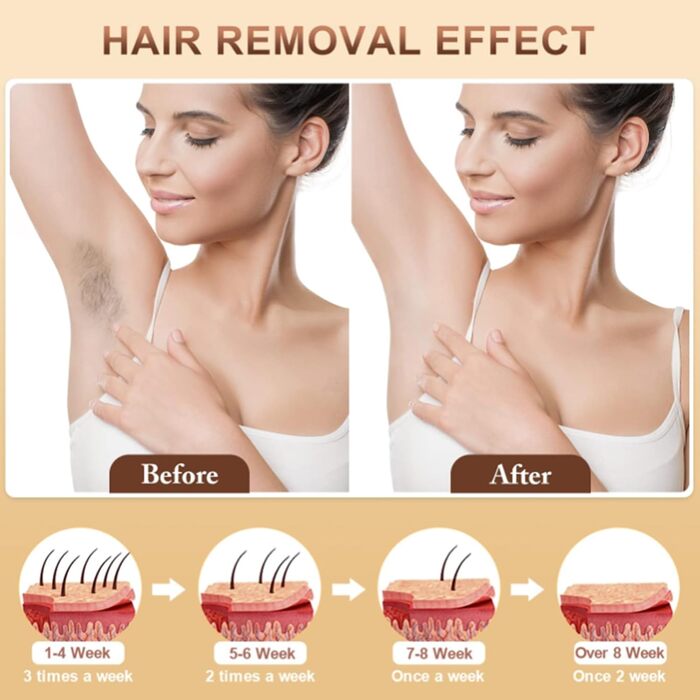 Пристрій для епіляції IPL: для жінок та чоловіків, 9 рівнів енергії, 999 000 імпульсів, безпечний для дому (обличчя, тіло, бікіні)