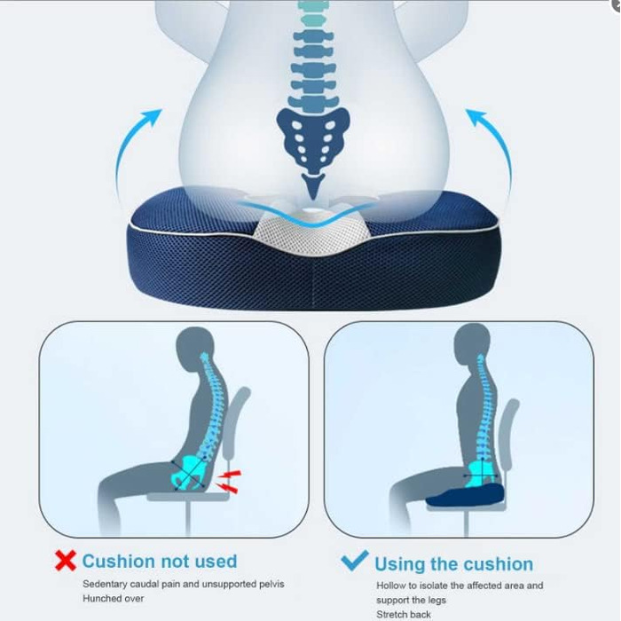 Donut Pillow Memory Foam Orthopedic Hemorrhoid Seat Cushion, Ergonomic Seat Cushion for Hemorrhoids and Prostate, for Pregnancy, Coccyx, Bed Sores, Post Natal, Sciatica (Female)